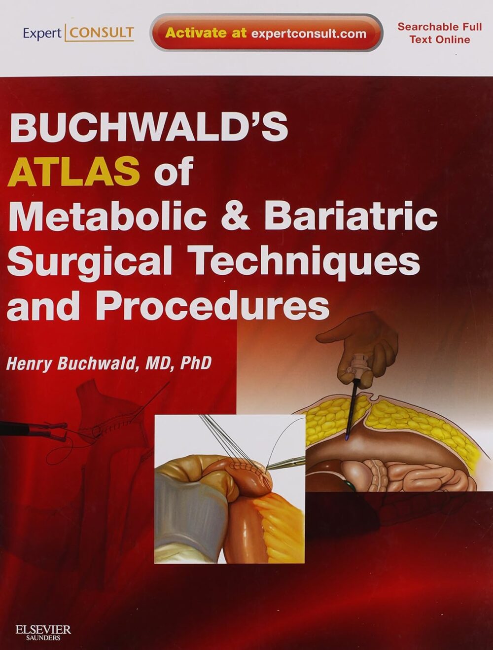 Buchwald's Atlas of Metabolic & Bariatric Surgical Techniques and Procedures